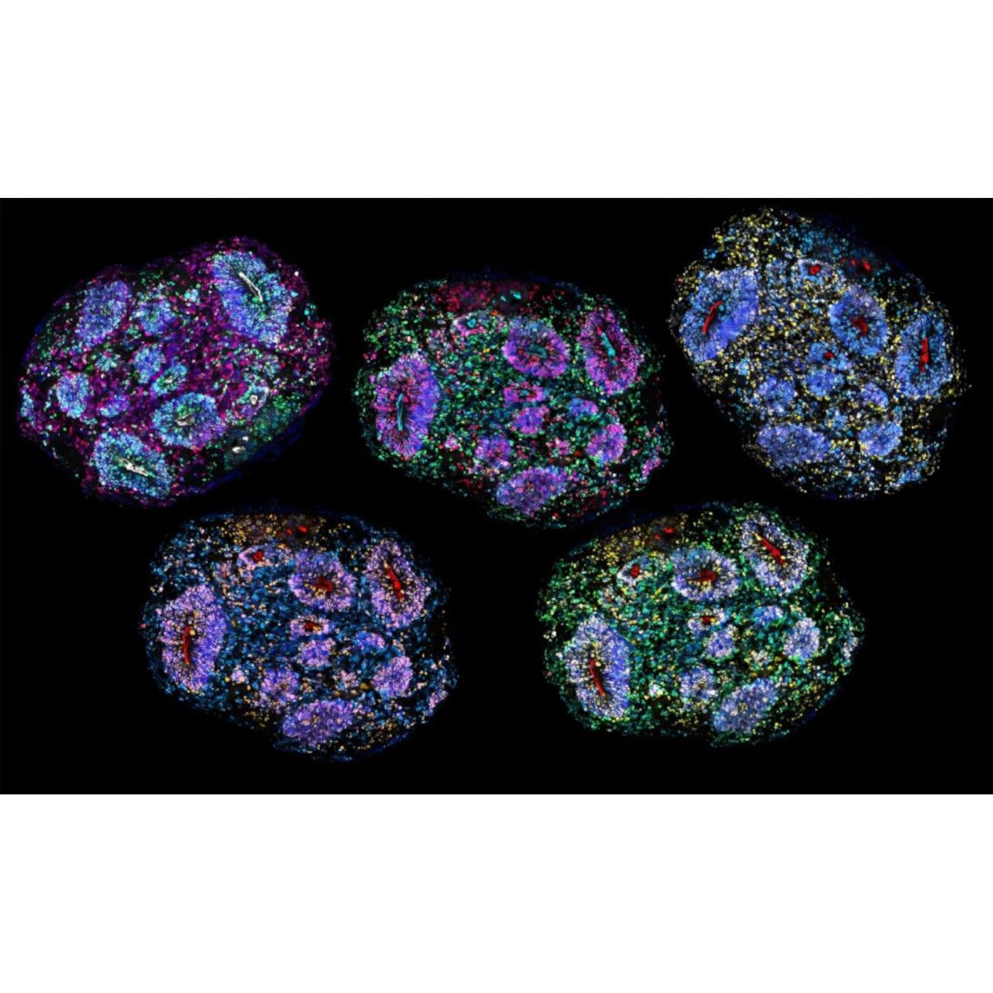 Lab-Grown Brain Organoids Age Like Real Brains and Record Development | Ancient Origins episode artwork