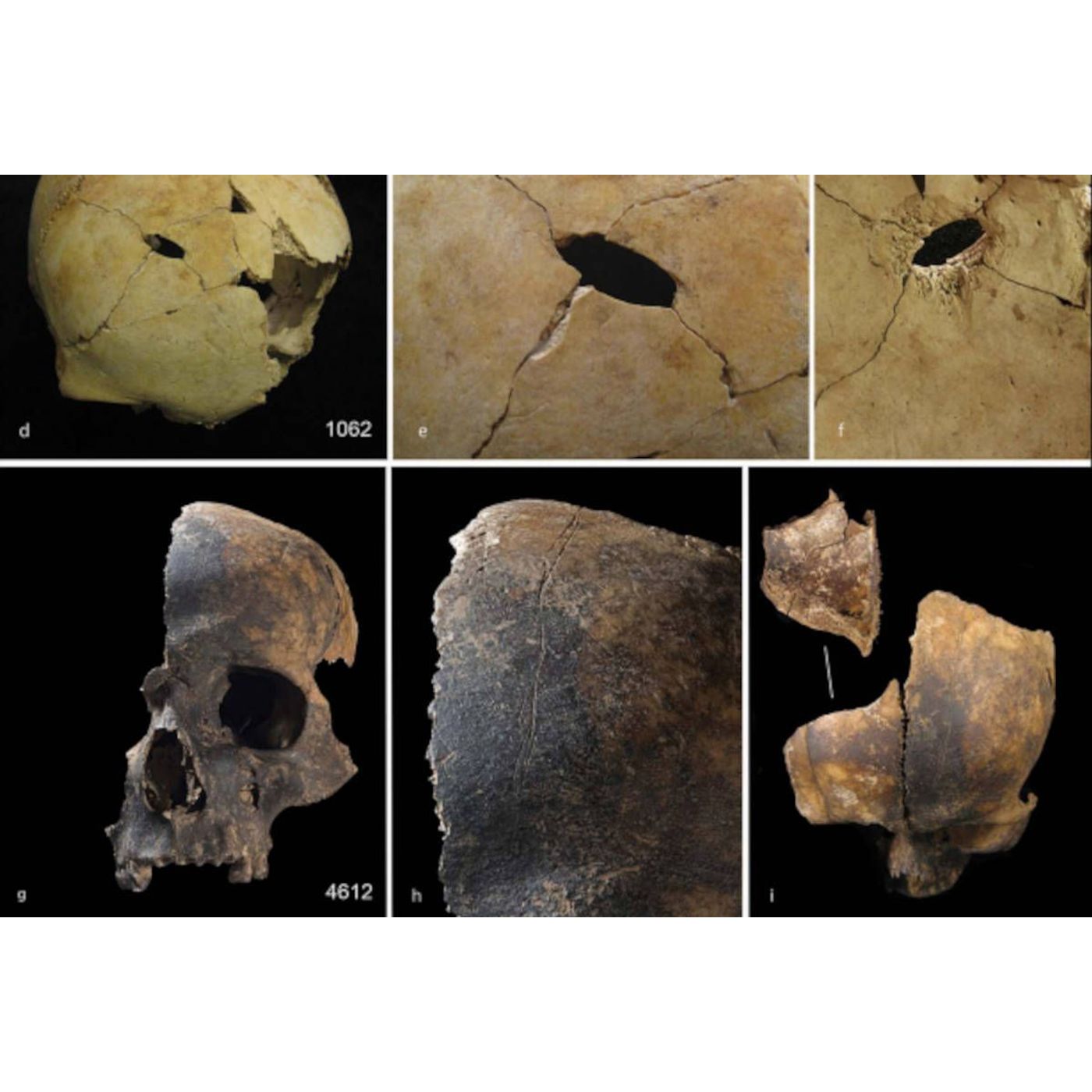 cover of episode Shocking Cycle of Violence and Cannibalism Revealed in Bronze Age Britain | Ancient Origins