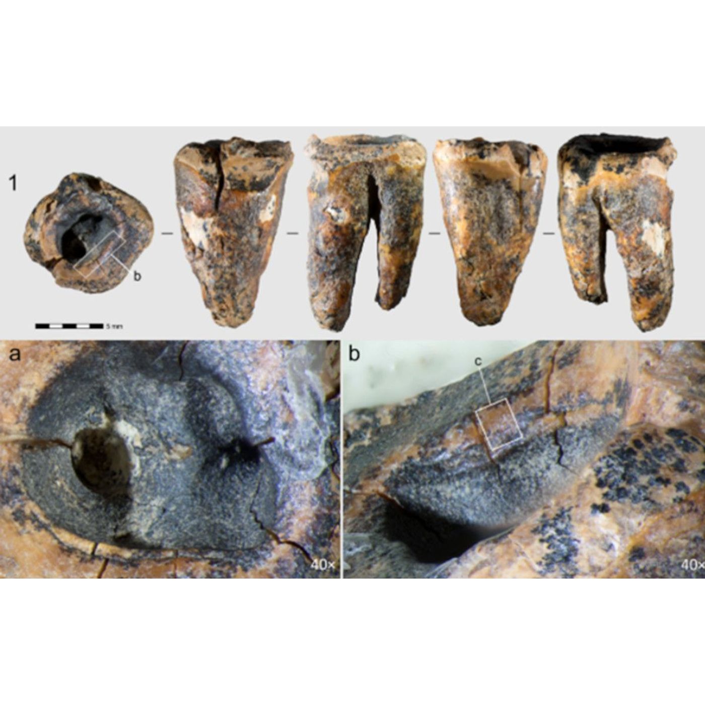 60,000-Year-Old Drilled Tooth Reveals Neanderthals Practiced Dentistry! | Ancient Origins episode artwork