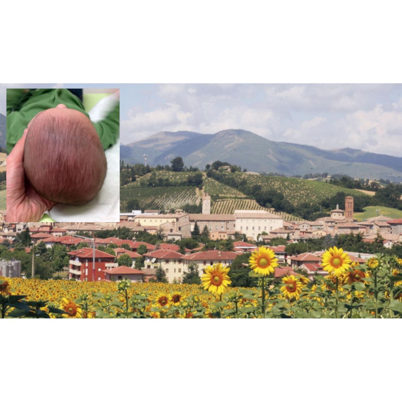Flat Head Syndrome Prevalent in 2,800-Year-Old Italian Skulls | Ancient Origins