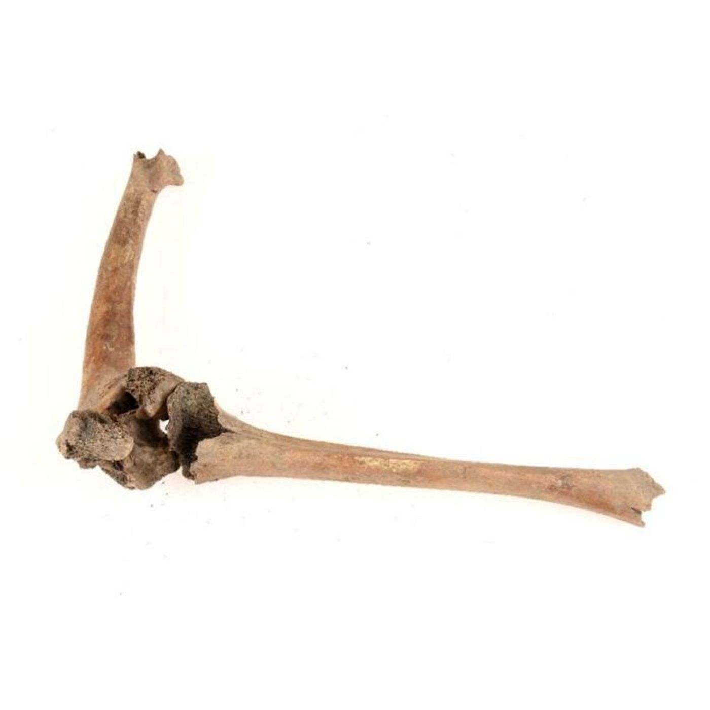 Fractured Bones Tell Us About Disability and Care in Sweden’s Middle Ages | Ancient Origins