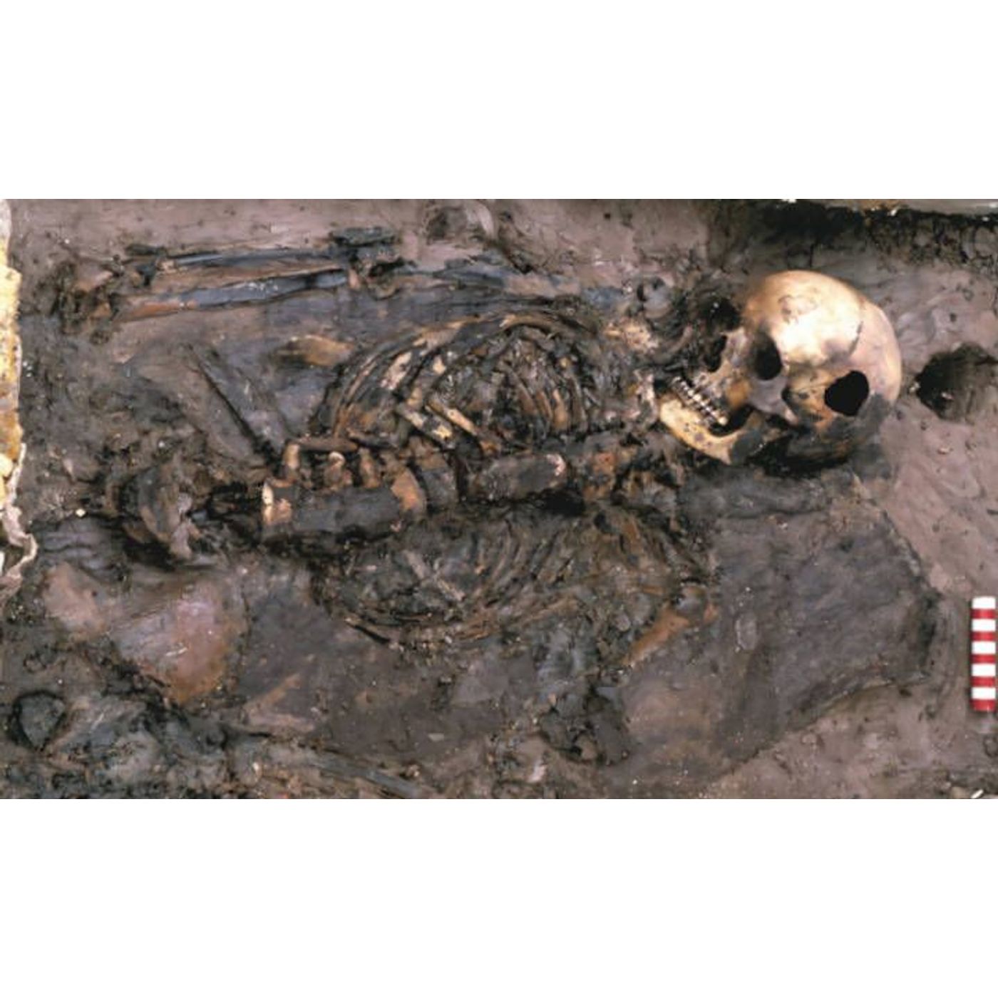 Brutal Justice on the Thames: Medieval Woman's Beaten Body Left as a Public Warning | Ancient Origins