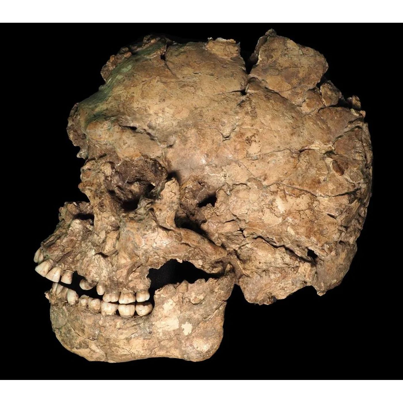 100,000-Year-Old Facial Wound Reveals Earliest Healed Violence in Homo Sapiens episode artwork