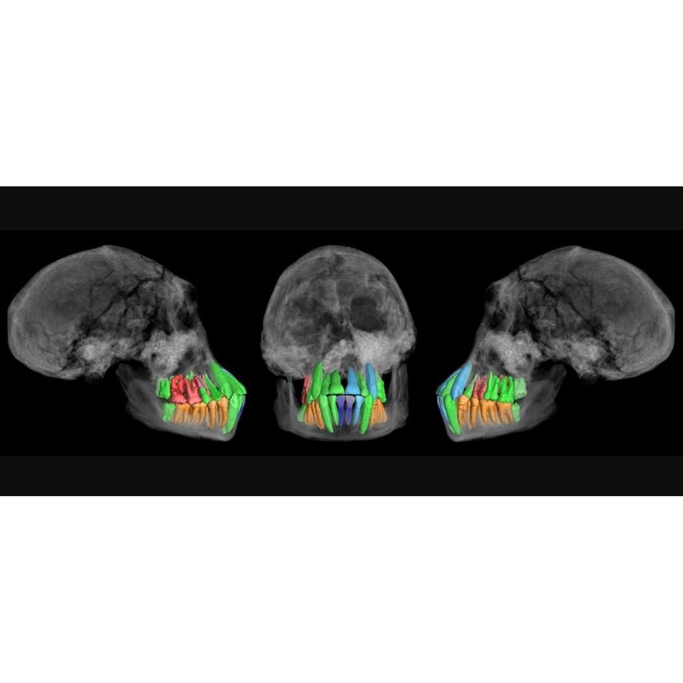 cover of episode Rate of Human Development First Slowed Down 1.77 million Years Ago | Ancient Origins